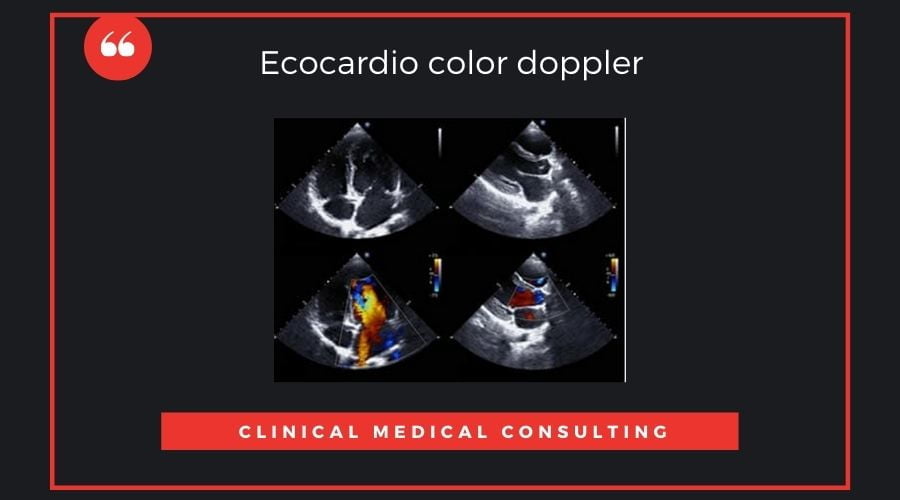 Ecocardio-color-doppler.jpg